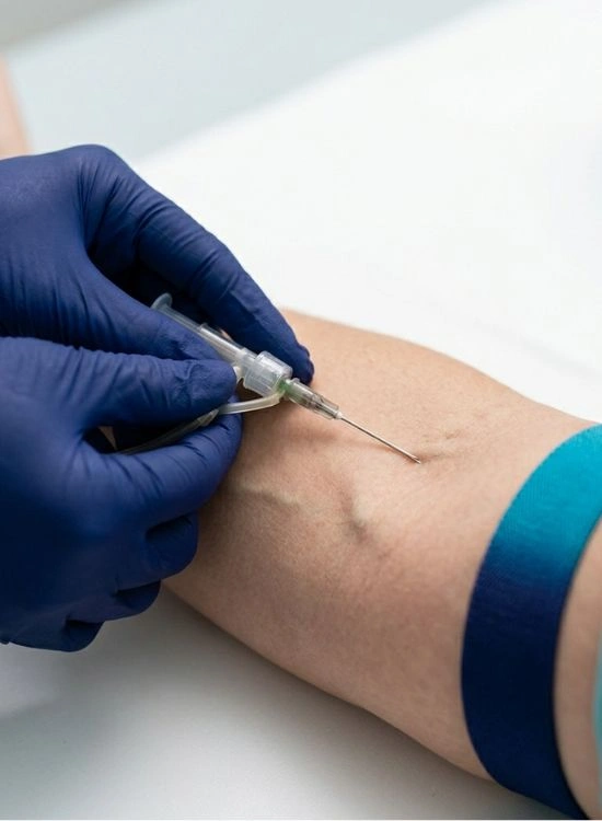 Venipuncture Techniques image